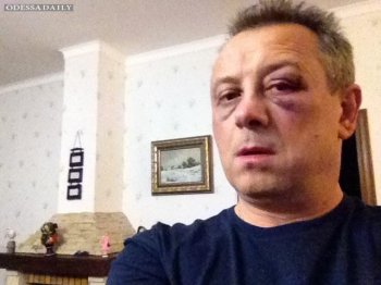 Одесские «УДАРовцы» пиарятся на избиении нардепа Владимира Куренного