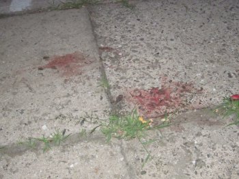 Будьте бдительны: орудует убийца (осторожно, фото)
