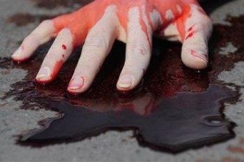 Очередное убийство в Одессе: Женщина скончалась от ножевых ранений