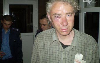 Самосуд в Одесской области: Журналист избит, квартира сожжена (фото)