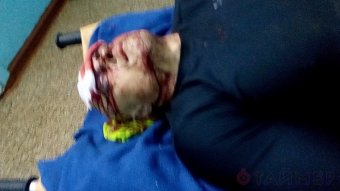 В Одессе неизвестные вооруженные люди жестоко избили активиста Евромайдана
