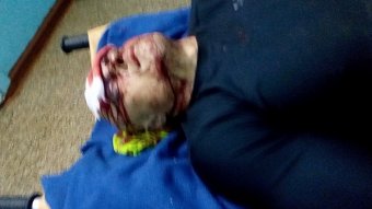 Избиение активиста одесского «Евромайдана» квалифицировали по статье 122 УК