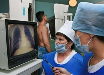 Одесситов приглашают на бесплатную флюорографию