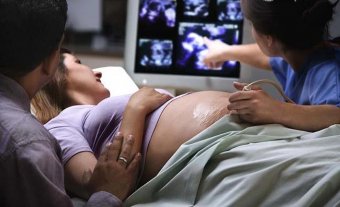 В 80-85% случаях врожденный порок серца диагностируется до рождения ребенка