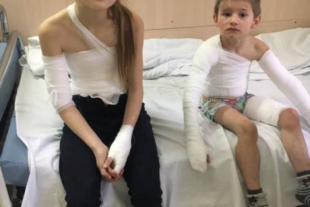 Обварились кипятком: в больнице водников спасают двоих детей (фото)