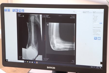 Детский диагностический центр на Дворянской обеспечен новым современным рентген-аппаратом (фото)