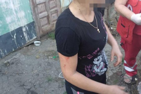 Пять человек пострадали в результате взрыва гранаты в Беляевском районе (фото)