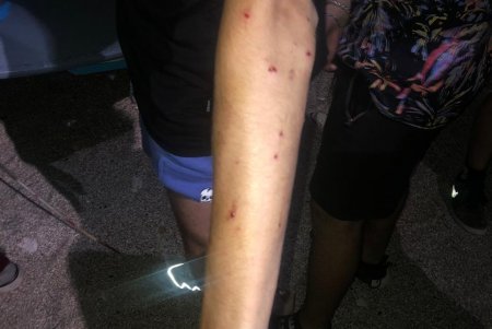 В районе 411-й батареи мужчина открыл стрельбу по шумной компании (фото, видео)