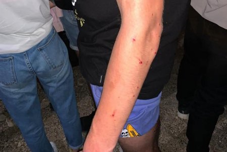 В районе 411-й батареи мужчина открыл стрельбу по шумной компании (фото, видео)