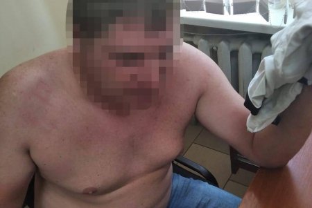 Под Одессой пьяный водитель убегал от полицейских, а при задержании начал кусаться
