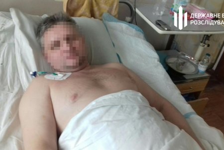В Одесской области полицейских обвиняют в избиении и пытках мужчины, из-за чего он получил инвалидность (фото)
