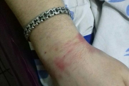 В Одесской области полицейских обвиняют в избиении и пытках мужчины, из-за чего он получил инвалидность (фото)