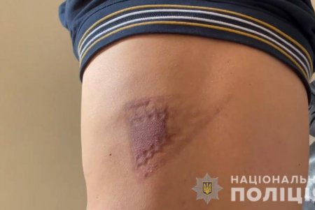 Двух иностранцев похитили, пытали несколько месяцев, отобрали 600 тысяч евро и шесть квартир в элитных районах Одессы (фото, видео)