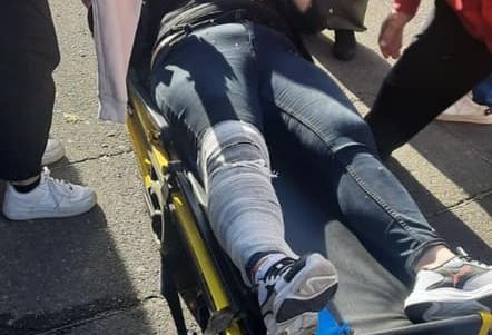 Женщина и подросток госпитализированы в результате падения с электросамокатов на Думской площади и Трассе здоровья (фото)