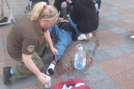 Женщина и подросток госпитализированы в результате падения с электросамокатов на Думской площади и Трассе здоровья (фото)