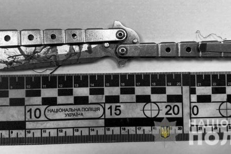 Нетрезвый житель Березовского района воткнул нож в живот 18-летнему прохожему (фото)