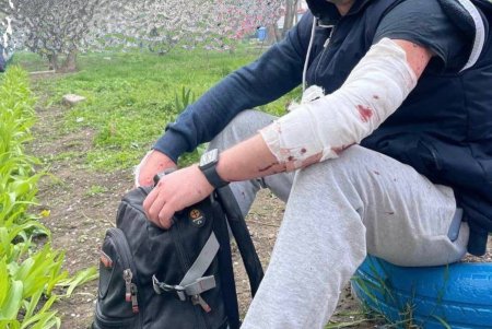 Одесский городской голова о ракетных ударах по городу: «Верю в возмездие и в справедливость. А значит — в победу Украины над извергами» (фото)