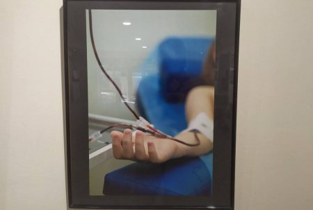 «От сердца к сердцу»: в Одессе открылась фотовыставка, которая популяризирует донорство (фото) 