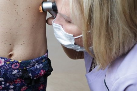 В Одессе прошли бесплатные осмотры по раннему выявлению меланомы и других злокачественных заболеваний кожи (фото, видео)