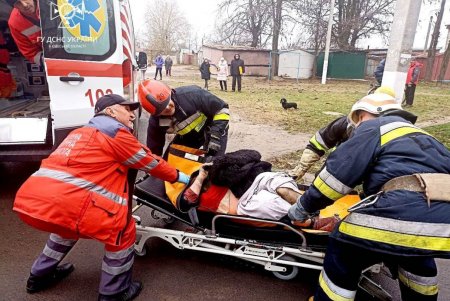 При пожарах в Одессе и области ожоги разной степени тяжести получили три человека: среди пострадавших — девятилетний мальчик (фото)