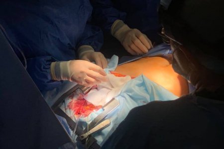В Одессе второй раз провели успешную трансплантацию сердца (фото)