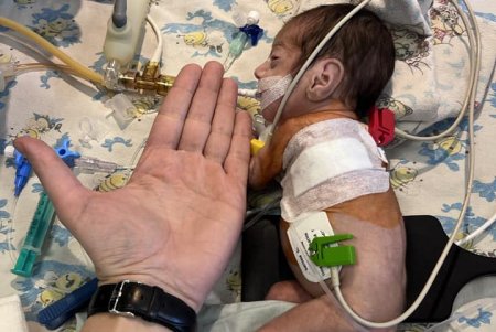 В областной больнице прооперировали двух новорожденных с врожденным пороком сердца (фото)