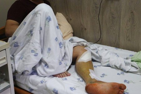 Пострадавшим в результате ночного удара оказывают помощь медики, а на местах разрушений работают коммунальщики (фото) 