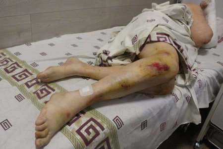 Пострадавшим в результате ночного удара оказывают помощь медики, а на местах разрушений работают коммунальщики (фото) 