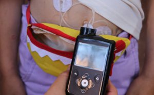 В Одессе впервые детей с сахарным диабетом обеспечат инсулиновыми помпами за средства городского бюджета (фото)