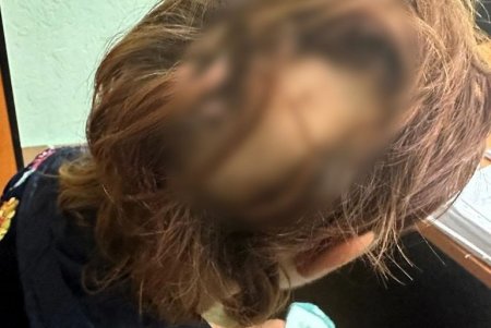 Житель Белгорода-Днестровского побил односельчанку и удерживал ее взаперти (фото)