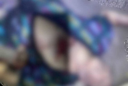 Убитые и пострадавшие, разрушенная инфраструктура, жилые дома и гостиницы: результаты массированного удара по Украине (фоторепортаж)