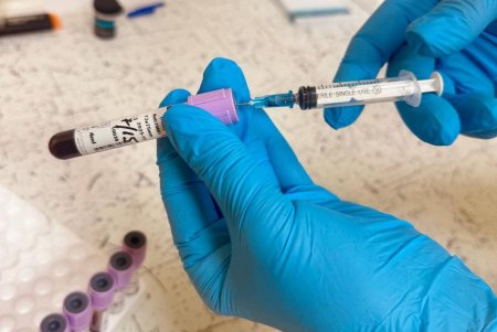 У медзакладах Одеси провели акцію з лабораторних досліджень крові з метою своєчасного виявлення онкопатології (фото)