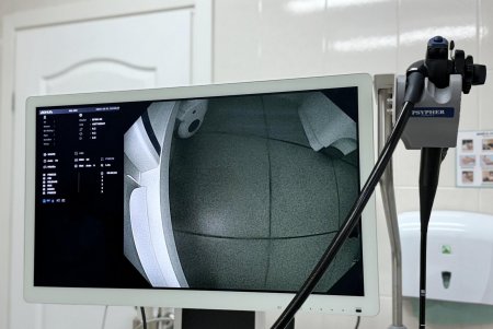 Одеський медзаклад отримав надсучасний фіброгастроскоп (фото)