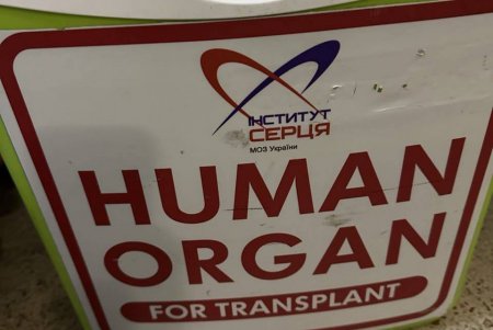 Один донор — три врятовані життя: в Одесі провели унікальну трансплантацію серця та нирок (фото)